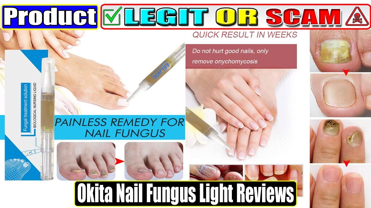 Okita Nail Fungus Light Reviews Consumer Reports