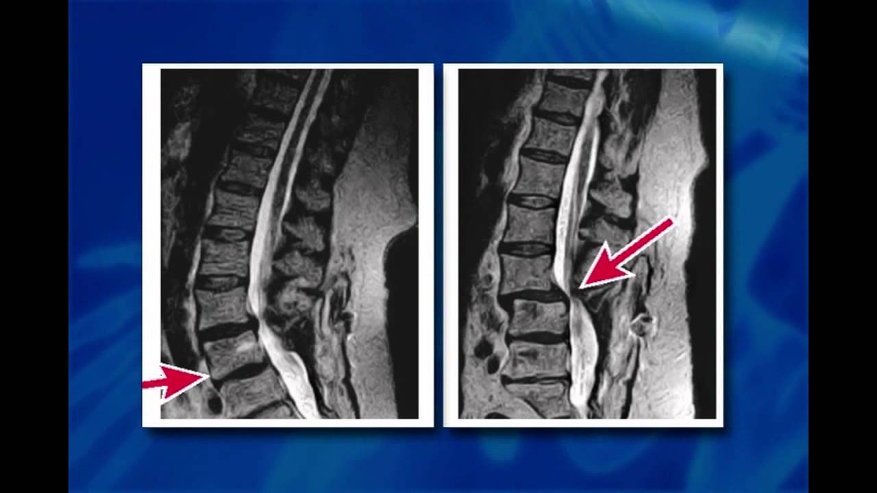 Open Stand Up MRI 1 - YouTube - Stand Up Mri Melville New York