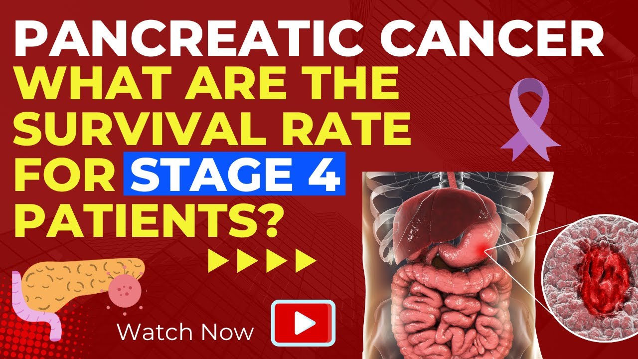 PANCREATIC CANCER | WHAT ARE THE SURVIVAL RATE FOR STAGE 4 PATIENTS - Stage 4 Neuroendocrine Pancreatic Cancer Life Expectancy