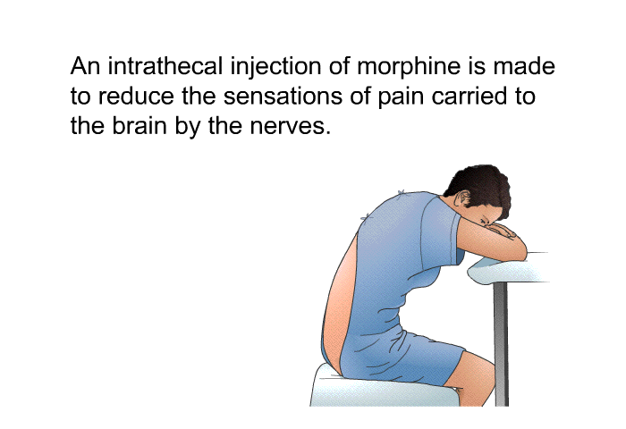 Intrathecal Injection Is Administered Into The