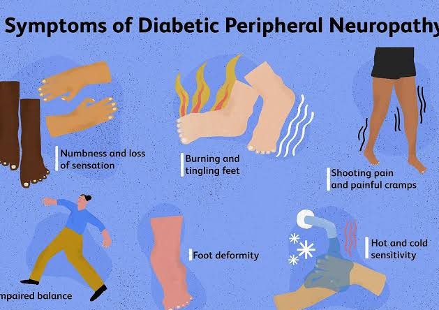 Can Peripheral Neuropathy Be Caused By Stress