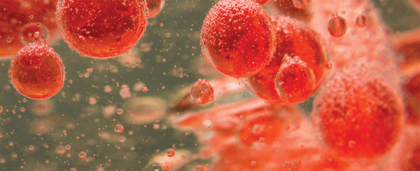 Peripheral Vascular Resistance: What Is It & Why It Should Matters - Choose All Of The Following That Affect Peripheral Resistance.