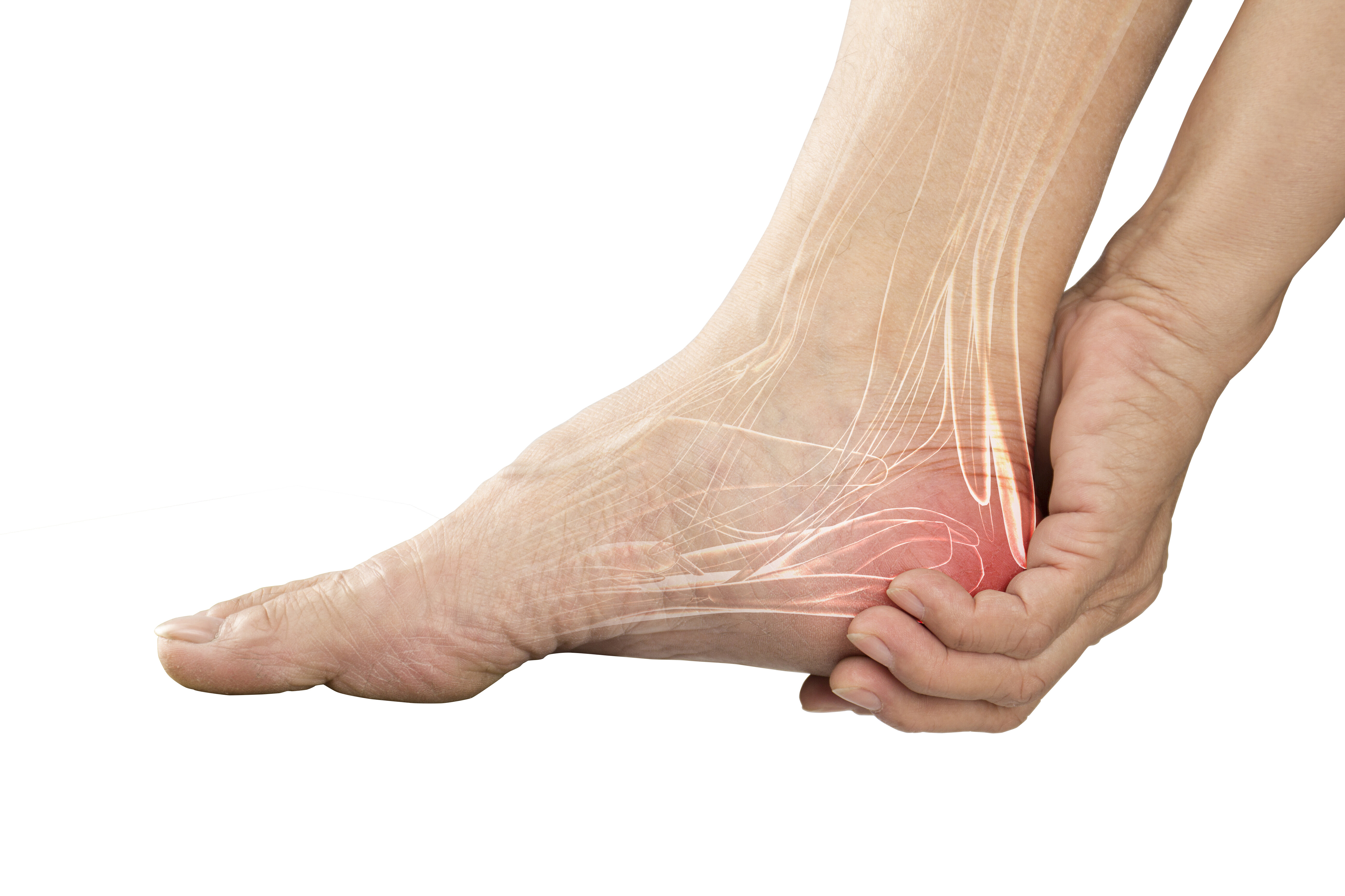 Plantar Fasciitis: Restoring Your Happy Feet - JOI Jacksonville - Foot And Ankle Associates Of Lancaster Pa