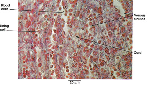 Plate 9.175 Spleen: Red Pulp - Label The Structures Associated With A Hair Follicle