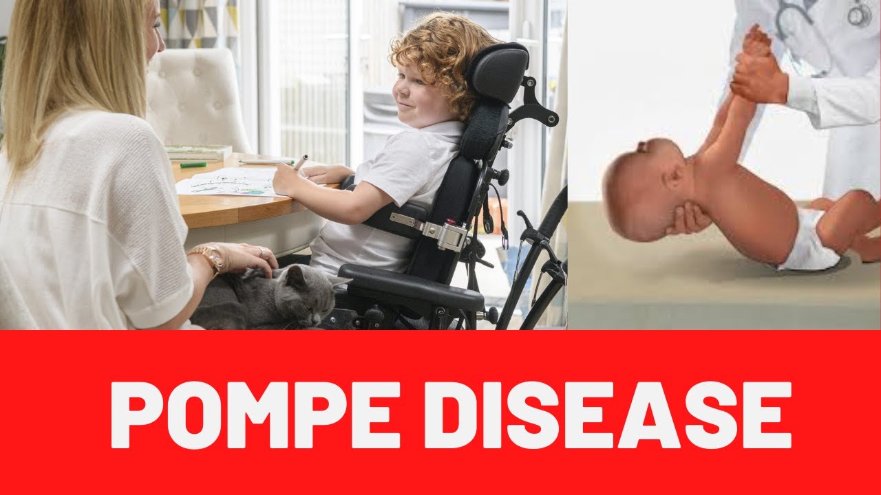 POMPE DISEASE Symptoms, Causes, Treatment, Diagnosis - YouTube - Pompe Disease Life Expectancy With Treatment