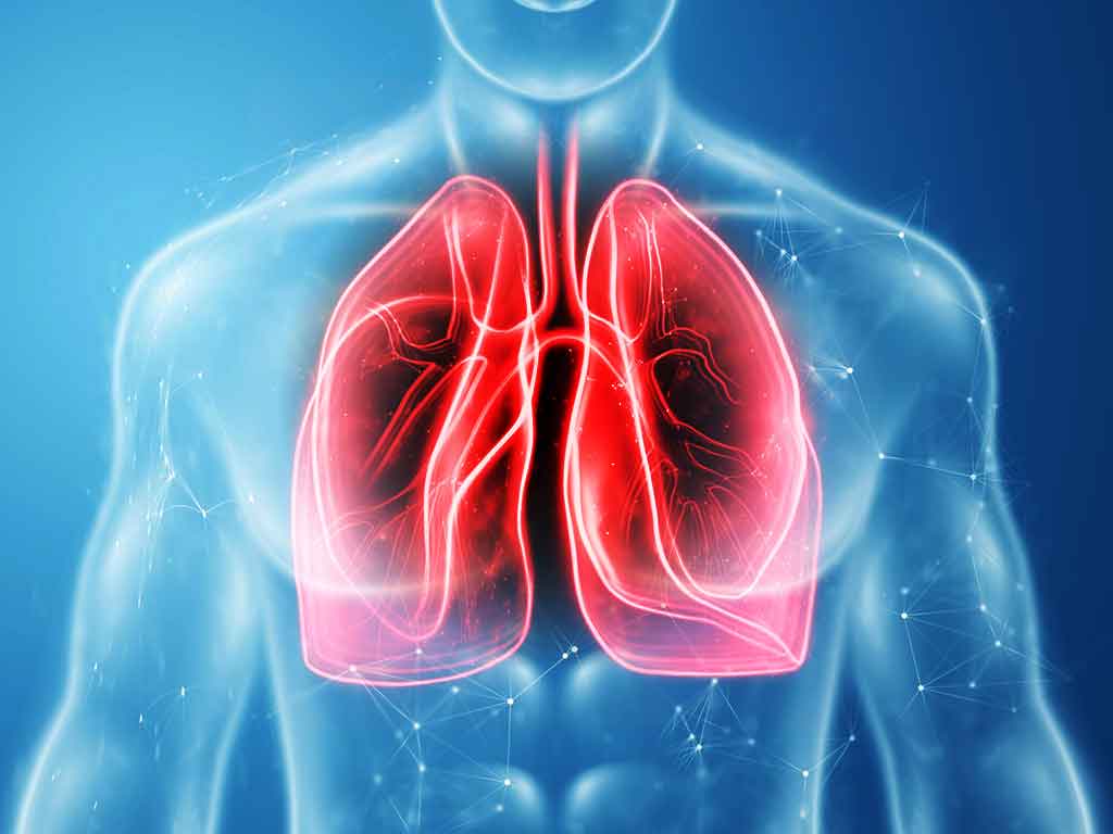 Pulmonary - Jewish Health Organization - Pulmonary Hypertension And Right Heart Failure