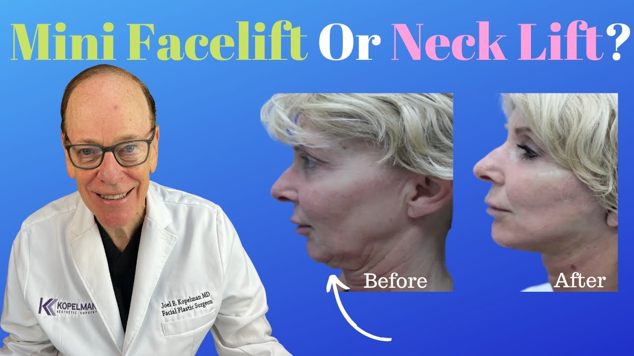 Reasons for a Mini Facelift or Neck Lift Surgery | Plastic Surgeon's - How Much Does A Mini Facelift Cost In Florida