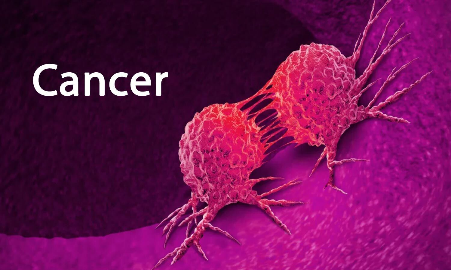 Researchers destroy cancer cells with ultrasound treatment - Do Cancer Cells Exhibit Contact Inhibition