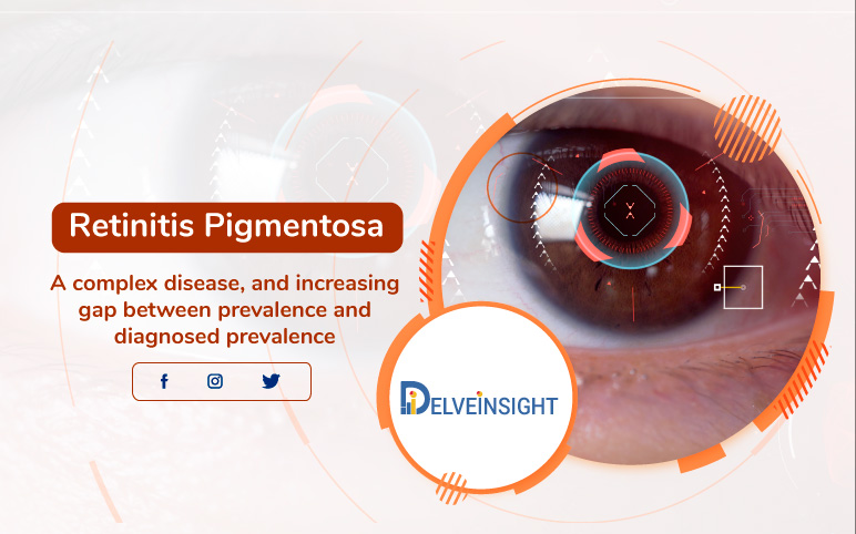 Retinitis Pigmentosa Epidemiology Forecast | Delveinsight - Retinitis Pigmentosamarketed And Pipeline Drugs Analysis