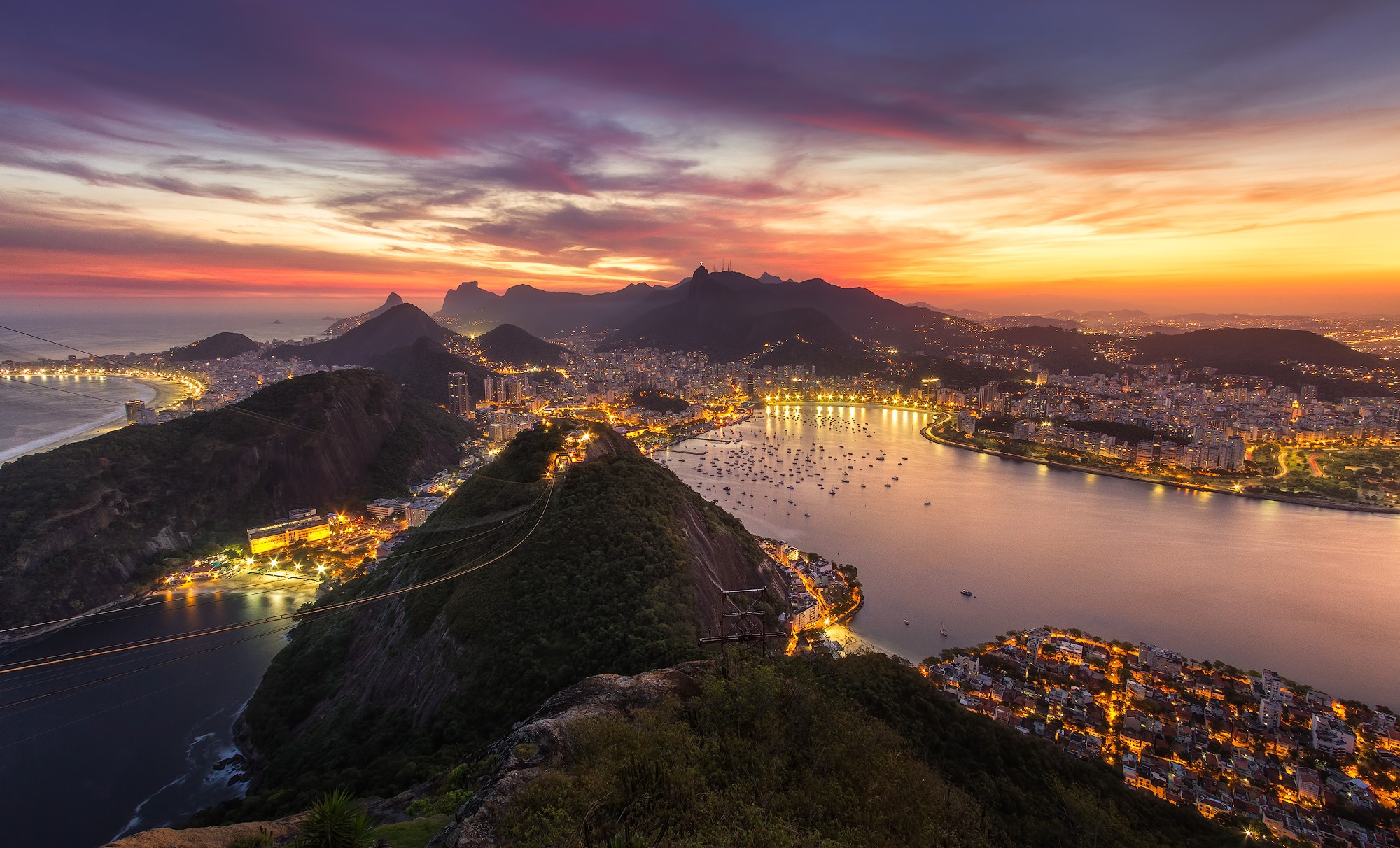 Brazil Adult Feeding Tubes And Formula Market