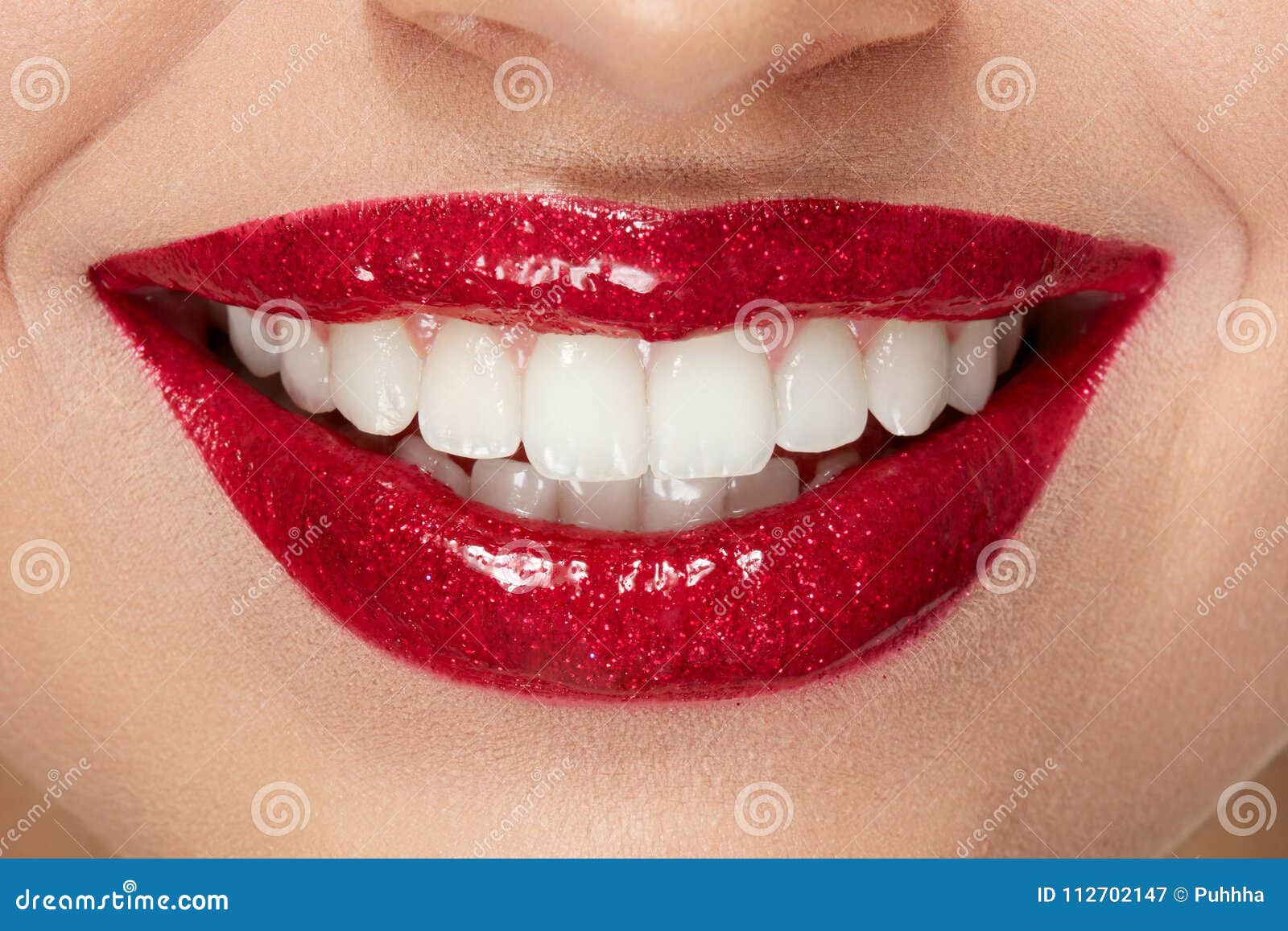 Smile Lips Teeth - Smile Direct Club Pro Whitening Wireless Kit
