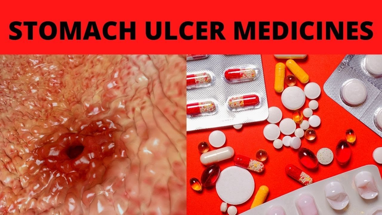 Stomach Ulcer Best Medicine || Stomach Ulcer Medicine || Stomach Ulcer - How Much Is Ulcer Drugs In Usa