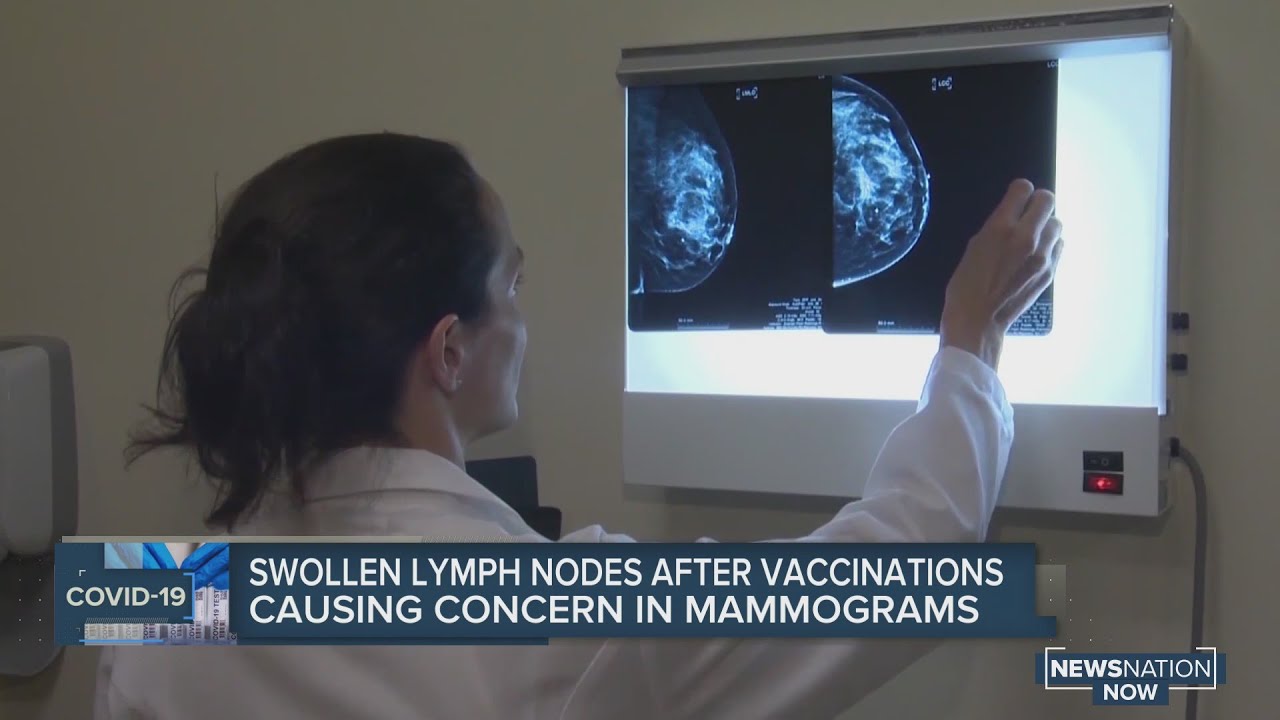 Swollen lymph nodes after COVID-19 vaccinations causing concern in - Swollen Lymph Nodes 12 Months After Covid Vaccine