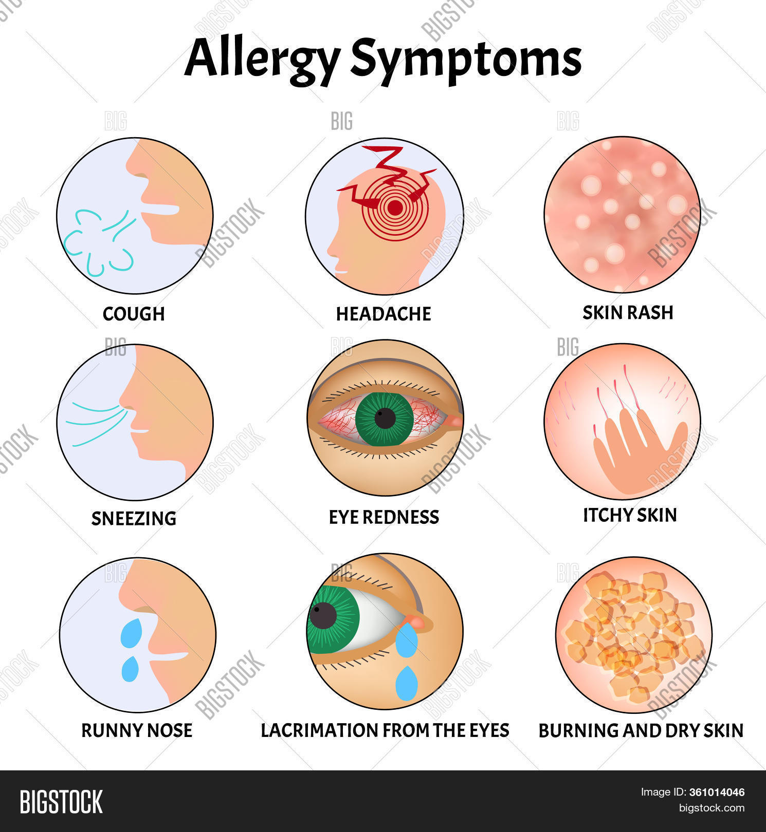 Symptoms Allergies Image & Photo (Free Trial) | Bigstock - Allergy And Asthma High Point Nc