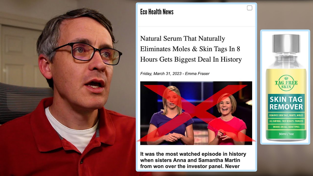 Tag Free Skin Tag Remover 'Shark Tank' Scam and Reviews, Explained - Derma Clear V2 Skin Tag Remover