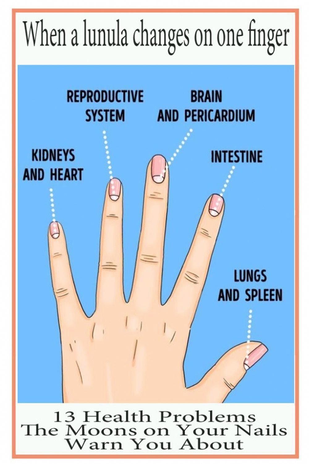 Nail Growth Occurs At The Nail