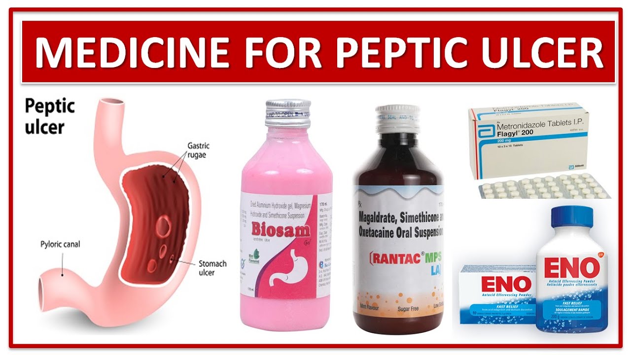 TREATMENT OF PEPTIC ULCER | MEDICINE USE TO TREAT PEPTIC ULCER DISEASE - How Much Is Ulcer Drugs In Usa