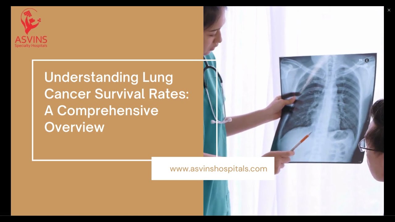 Lung Cancer And Heart Failure Life Expectancy
