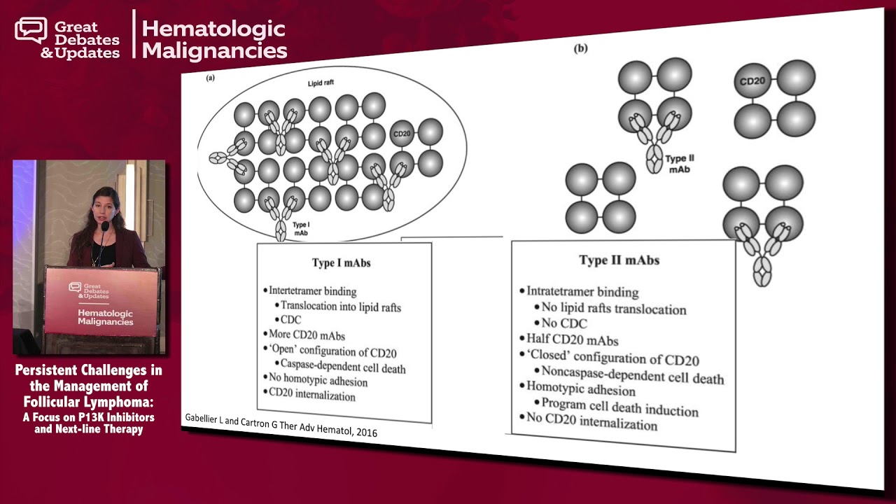 Update: Relapsed/Refractory Follicular Lymphoma - YouTube - 3l Relapsed Refractory Follicular Lymphoma Drug Epkinly