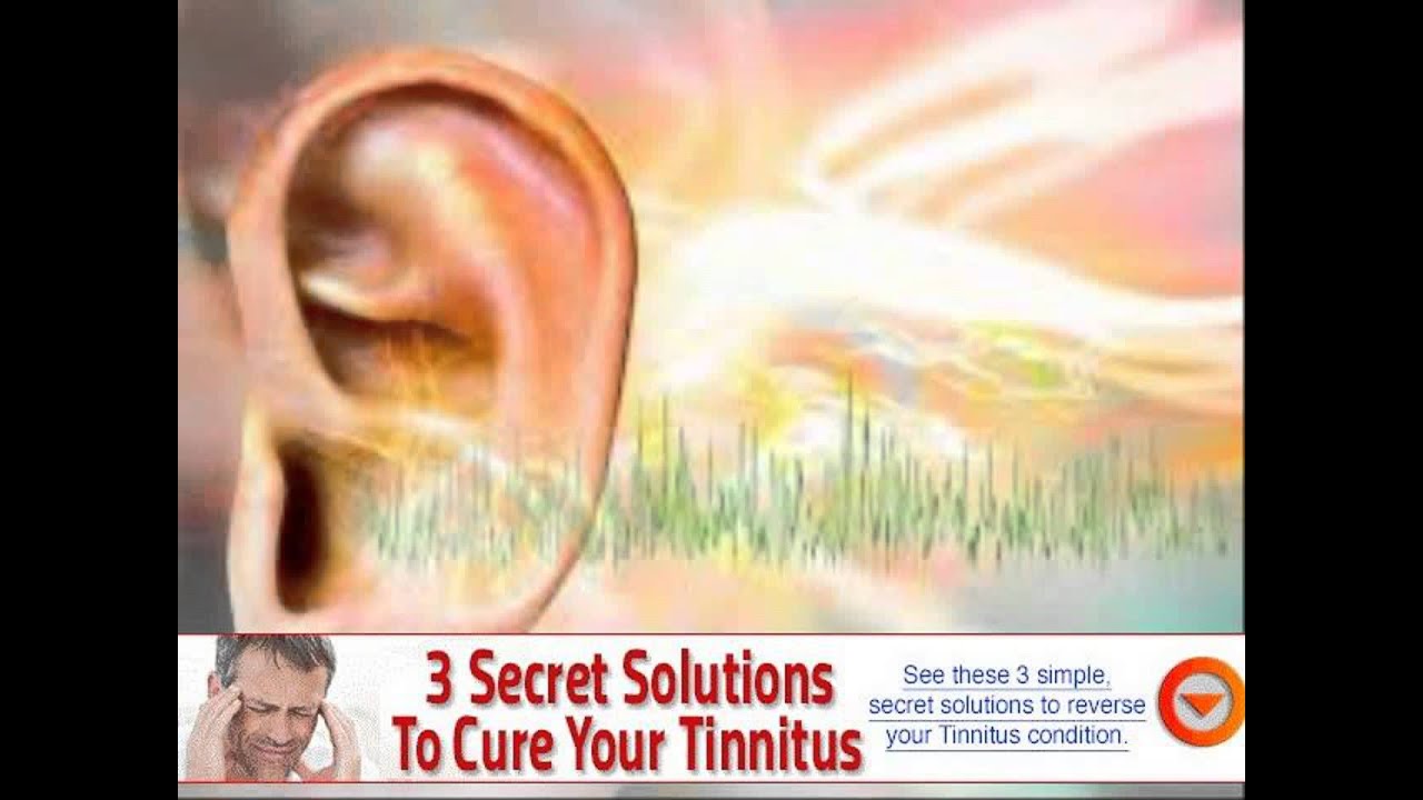 vitamin b12 deficiency symptoms tinnitus - YouTube - How Much Vitamin B12 For Tinnitus