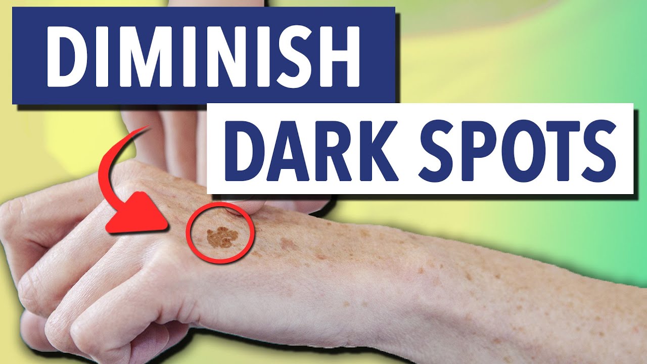 What Makes Gundry MD Dark Spot Diminisher Different? - YouTube - Gundry Md Polyphenol Dark Spot Diminisher