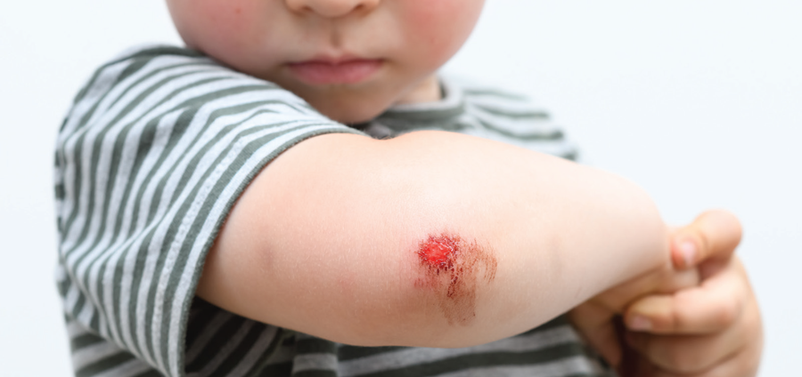 Wound care - Wounds - Wound Closure Medical Devices Product Pipeline Market