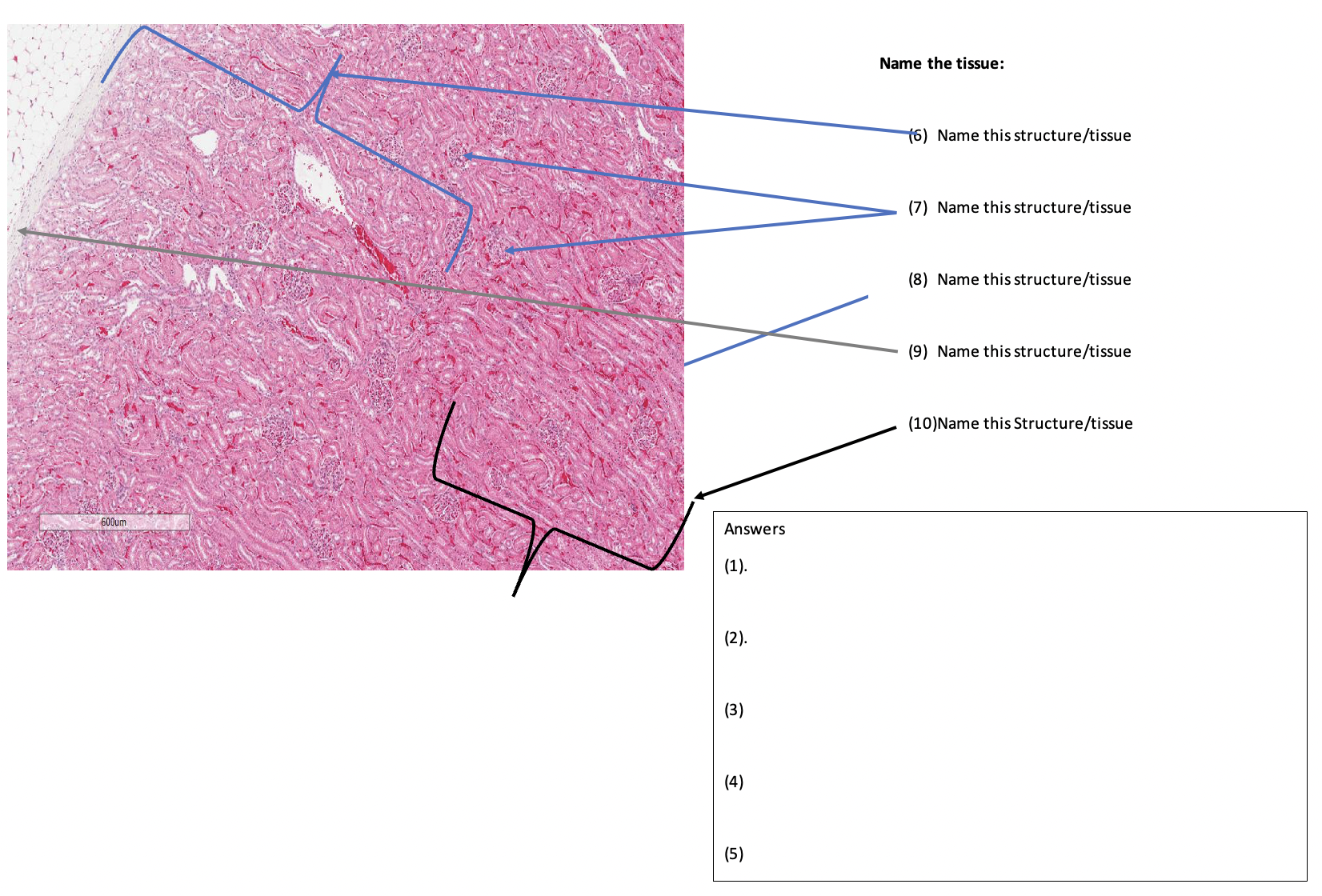 You have been provided with (10) ﻿ten tissue types. | Chegg.com - Label The Structures Associated With A Hair Follicle