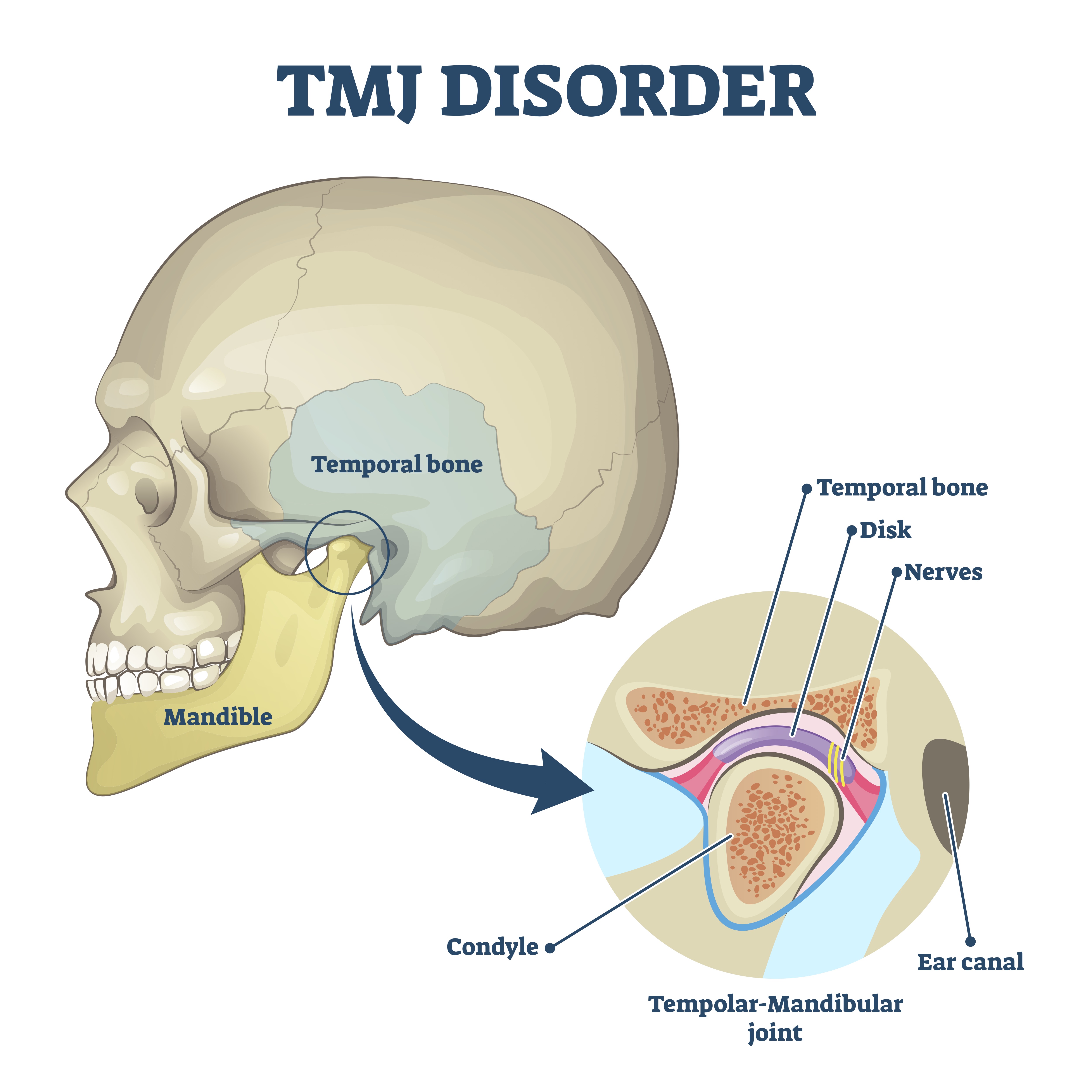 Does Tmj Surgery Change Your Face